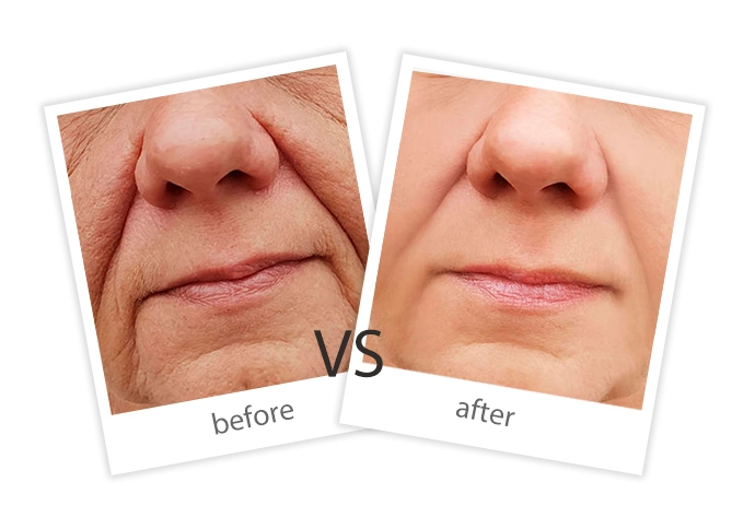 Facial Treatment-10