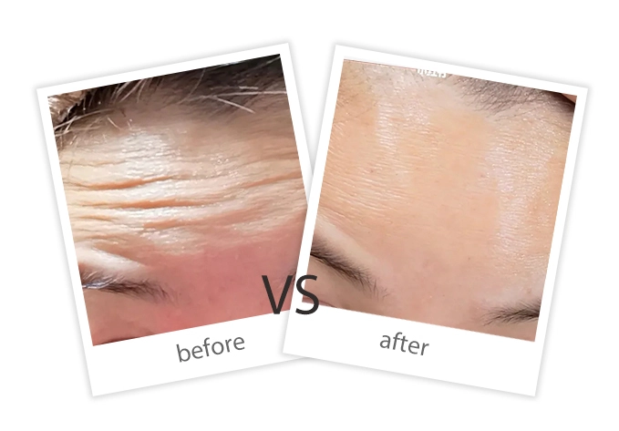 Facial Treatment-8
