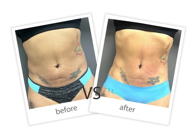 Weight Loss & Build Muscle-14