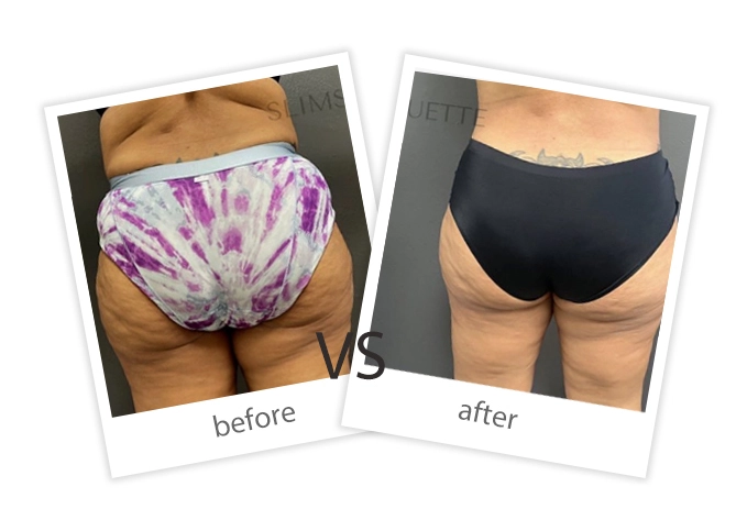 Weight Loss & Build Muscle-15