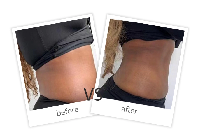 Weight Loss & Build Muscle-22